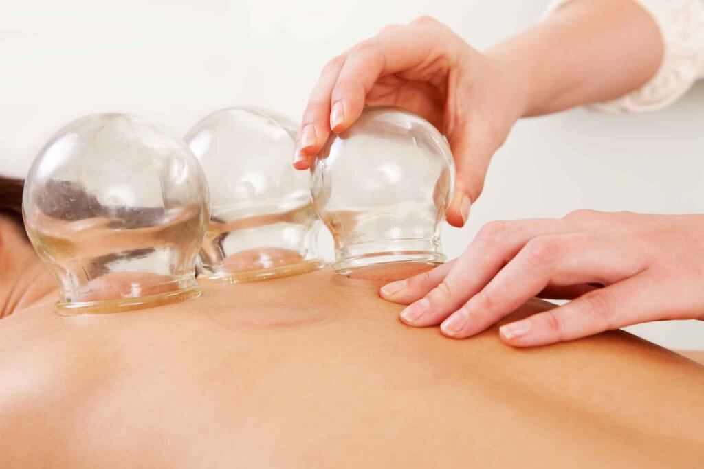 Cupping a patient