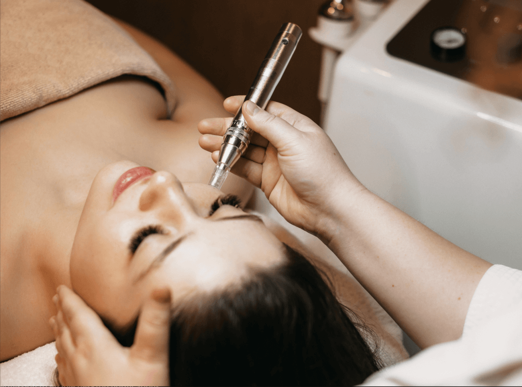 Unlock Radiant Skin with Microneedling