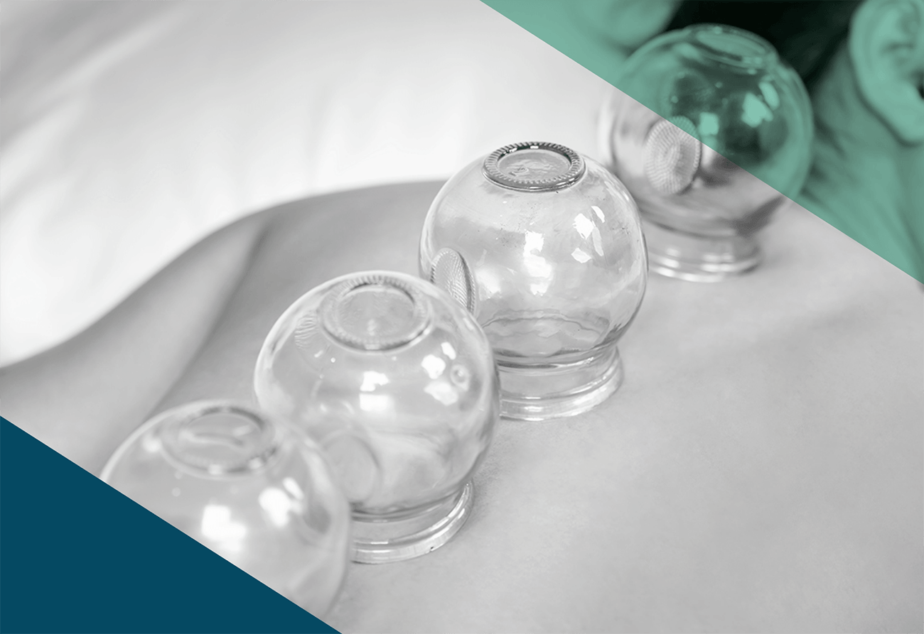 Cupping Techniques for Recovery and Mobility